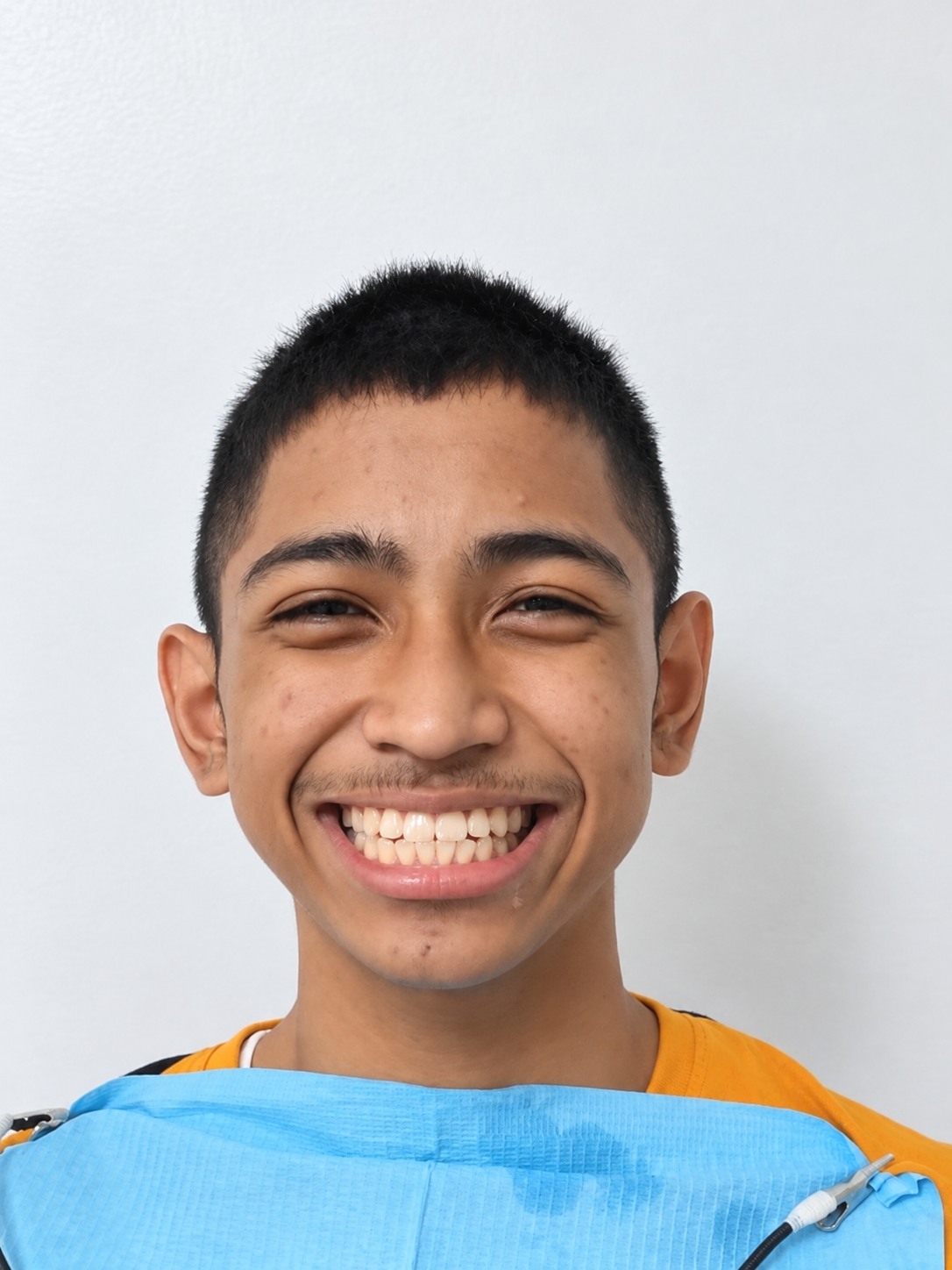 Retouched patient portrait, used for private layout preview